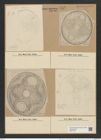 Auliscus punctatus var. circumductus Rattr (de-Toni-Nr.: Genus 171, Species 4326) Zeichnungen Sammlung Grunow Nr. 7892 (NHMW-BOT-W0377160)